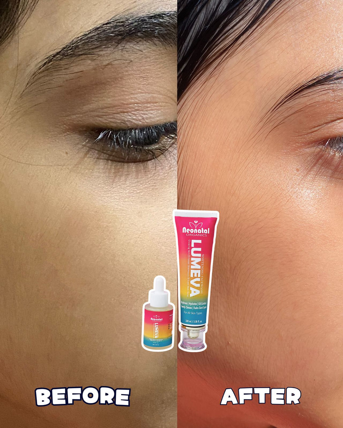 Brightening Bundle