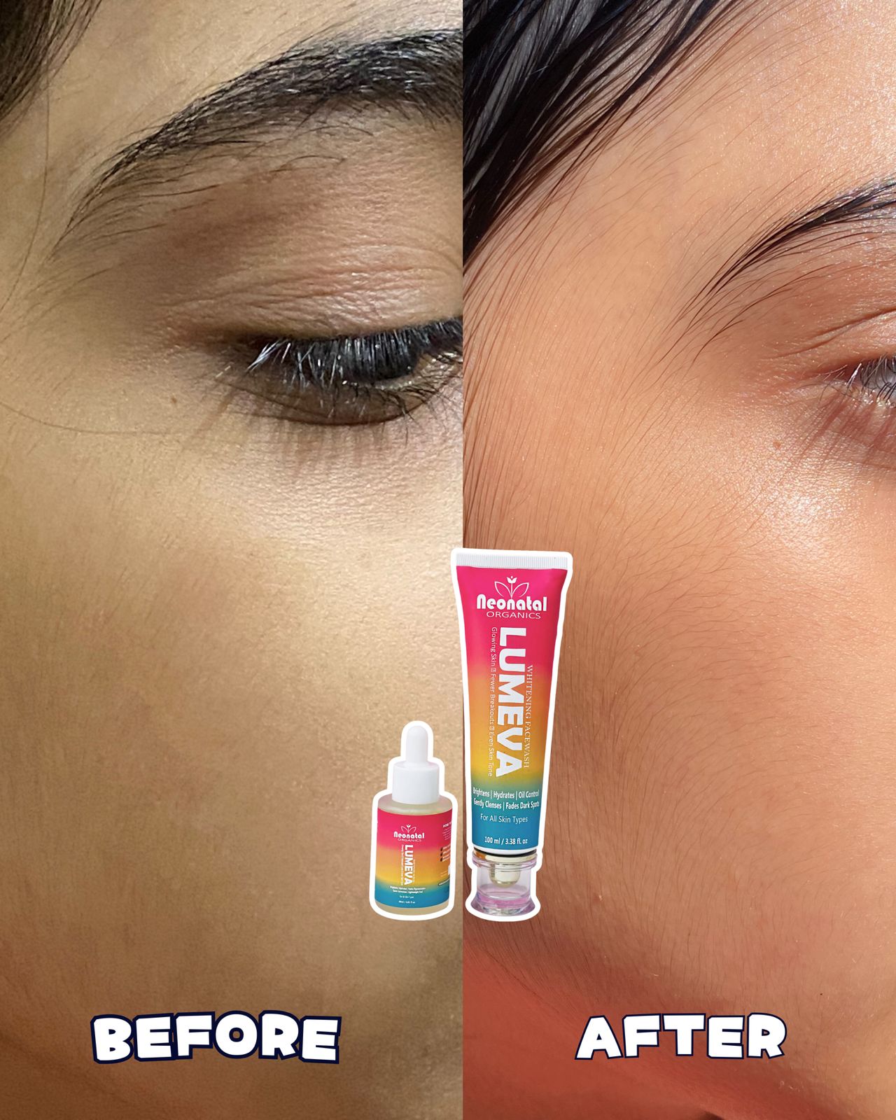 Brightening Bundle