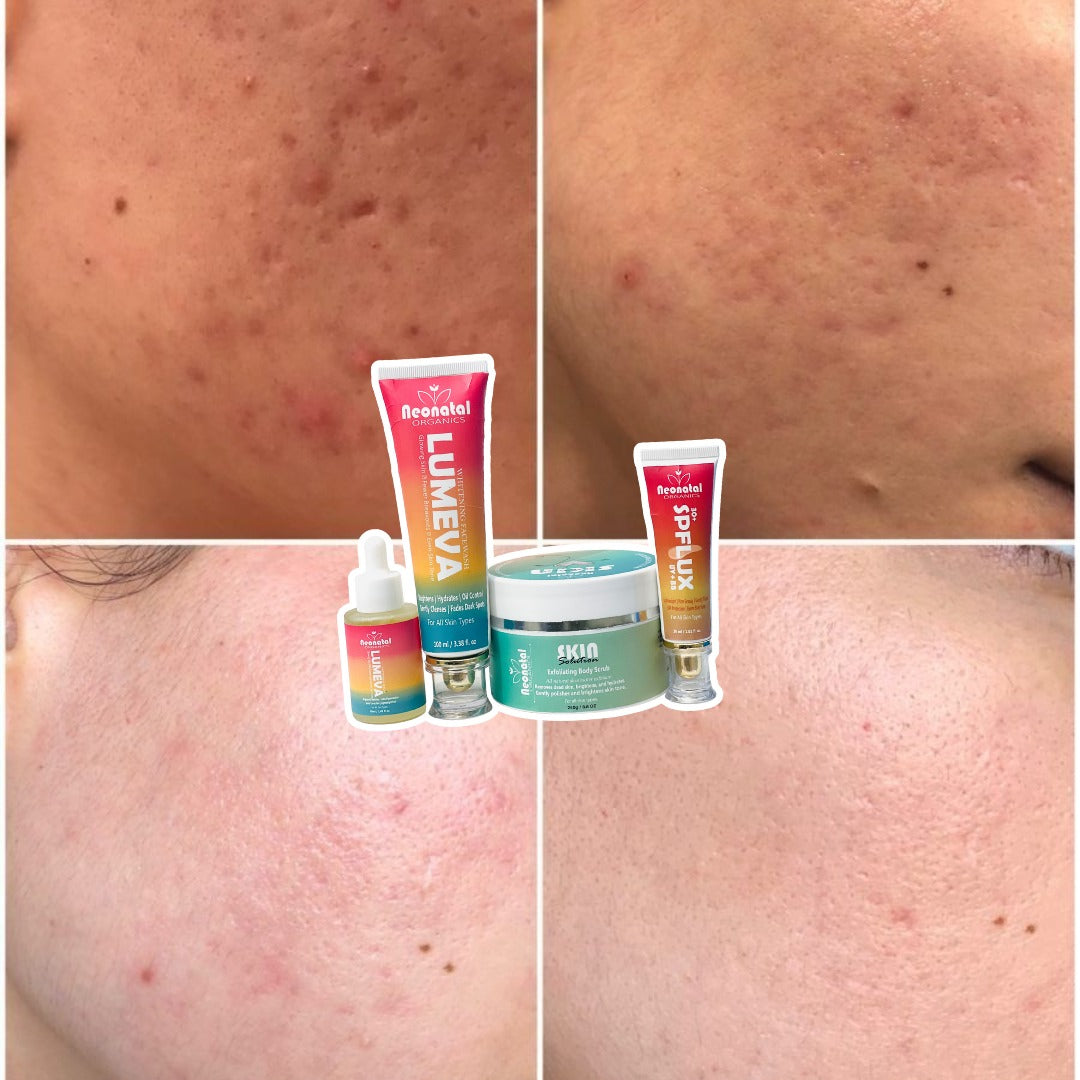 All-in-One Skincare Bundle